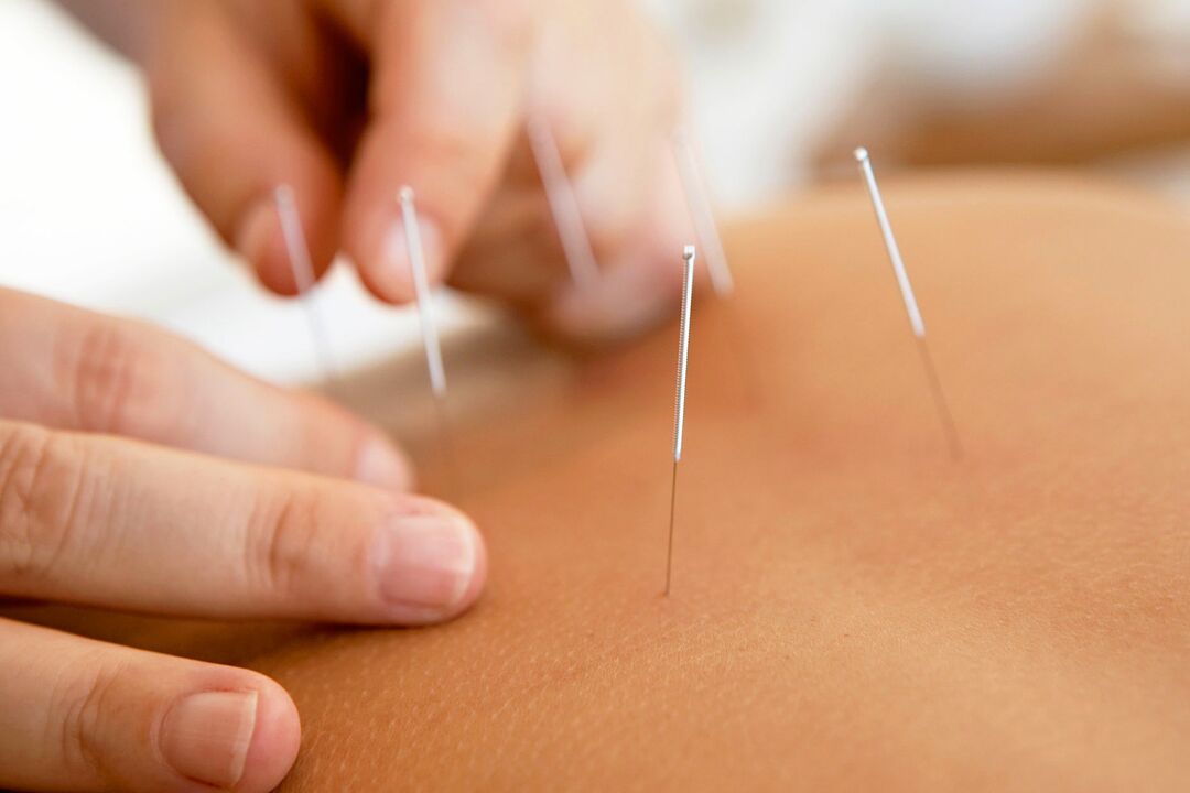 acupuncture upang madagdagan ang lakas