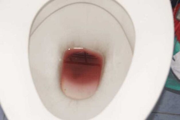 spotting sa mga lalaki kapag excited